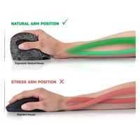 CONNECT IT FOR HEALTH DOODLE ergonomická vertikální myš, (+ 1x AA baterie zdarma), bezdrátová