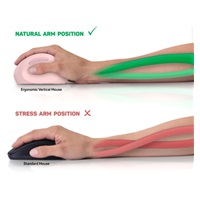 CONNECT IT FOR HEALTH LADIES PINK Bezdrátová vertikální myš, ergonomická, růžová